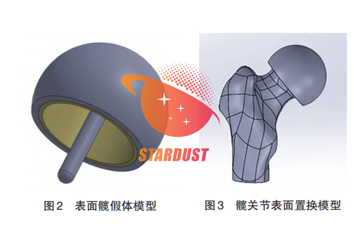 表面髋关节置换中假体材料对股骨应力的影响研究